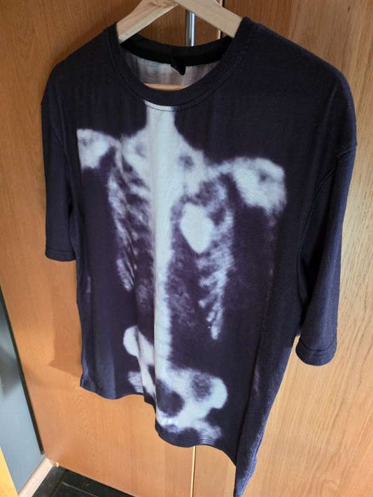 X-ray bolur